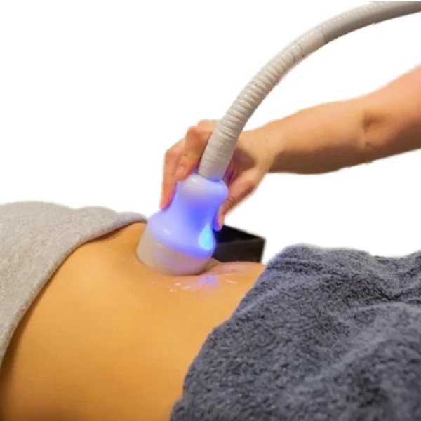 cryo-t-shock